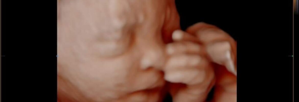 Heavenly Baby HD 2D 3D 4D Ultrasounds!