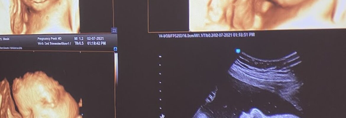 Pregnancy Peek 4D/HD Live Ultrasound Studio