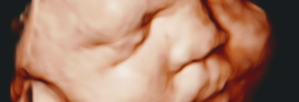 One Like Me 3D/4D Ultrasound