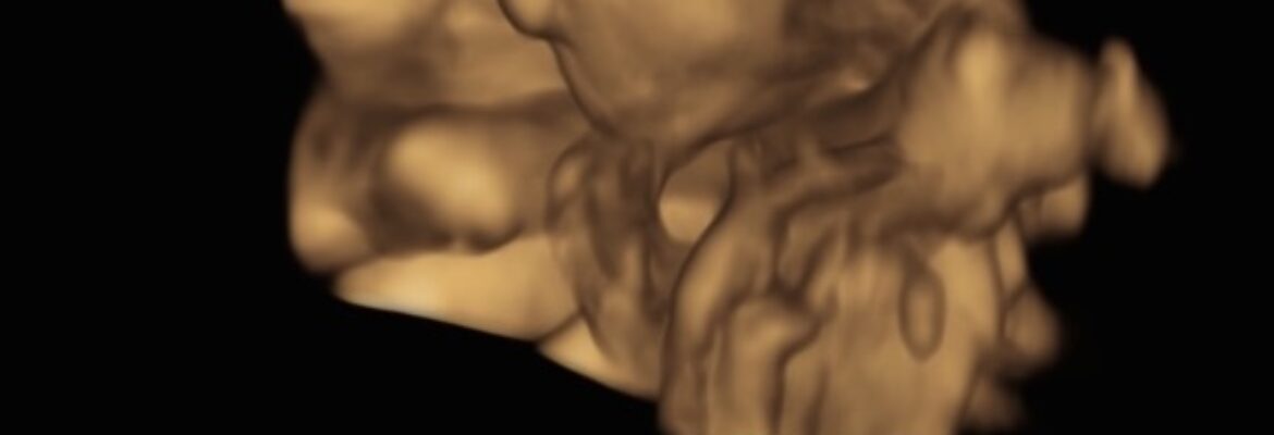 Little Me 3D Ultrasound Studio